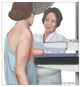 standard mammogram